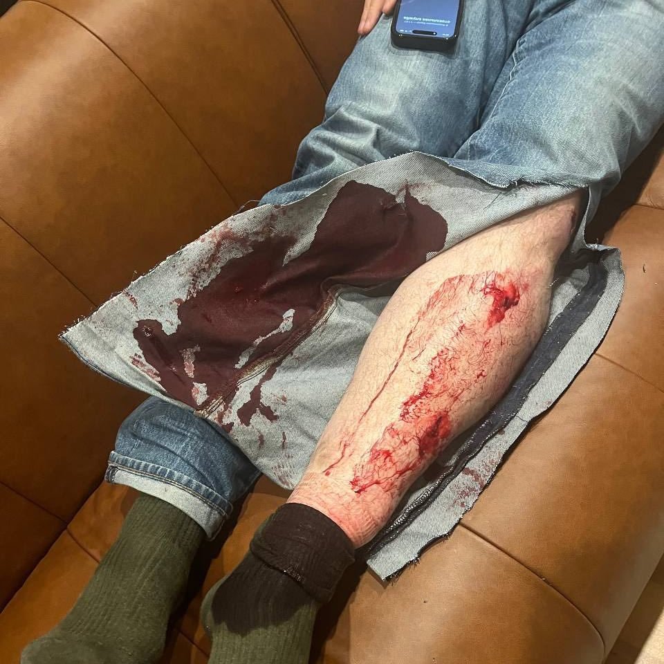 k_sonin's tweet photo. One of the exiled leaders of the Russian opposition, @navalny's trusted chief of staff @leonidvolkov was attacked with a tear gas and a hammer outside his home in Northern Europe. https://t.co/Yf1bRZcdzl