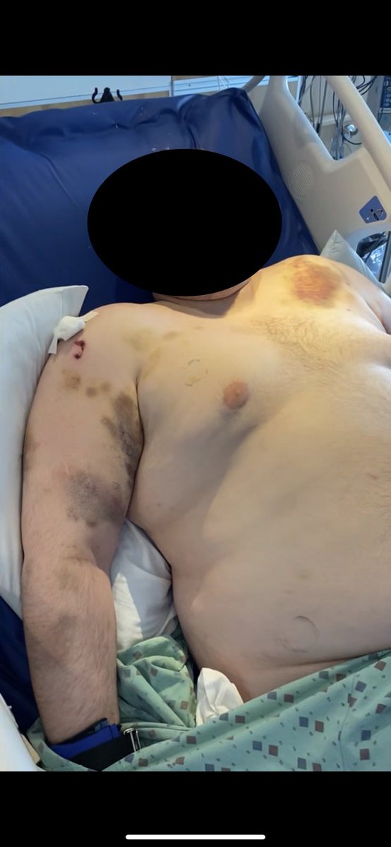 WildRoseForest's tweet photo. This is just some of his injuries. He is so confused and scared. I don’t know what the fuck happened to him. There are several inconsistencies between his chart, doctors, and staff. This is horrifying! The only thing we can do now is wait for answers from the investigation 4/4 https://t.co/m2QnfGu6aE
