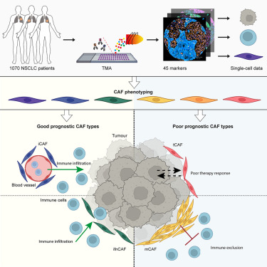 Cancer-associated fibroblast phenotypes are associated with patient outcome in non-small cell lung cancer dlvr.it/T3zLZH