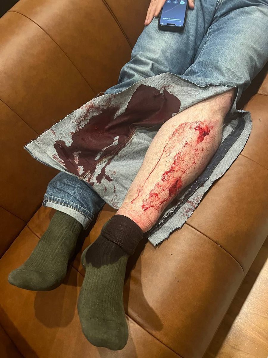 Leonid Volkov @leonidvolkov - my dear colleague and a member of Alexei Navalny's team - has just been attacked outside his house in Europe. Someone broke a car window and sprayed tear gas in his eyes, after which the attacker started hitting Leonid with a hammer. Leonid is…