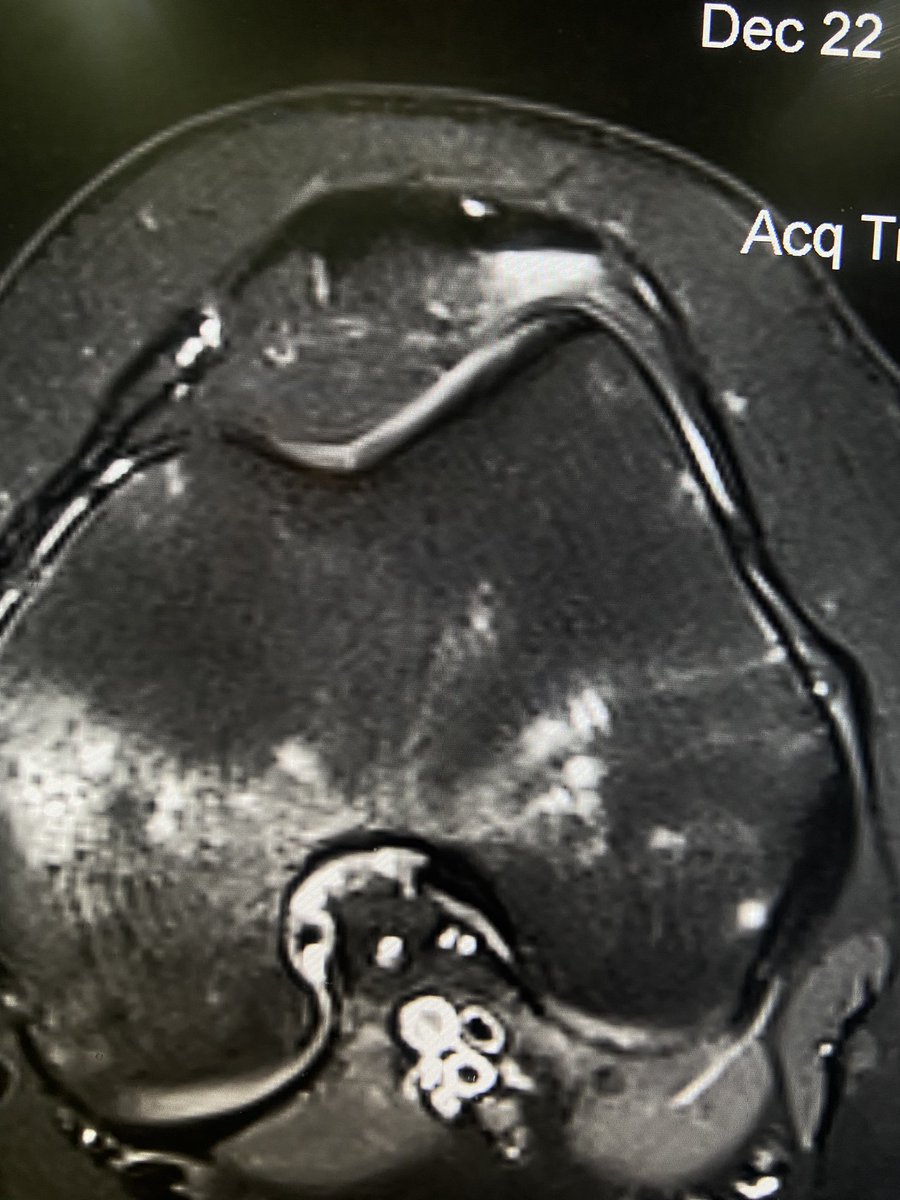 Thamer⁦ Alghamdi tweet media