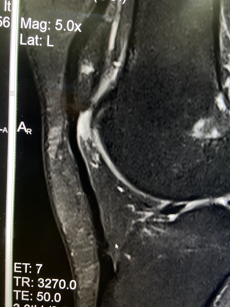Thamer⁦ Alghamdi tweet media