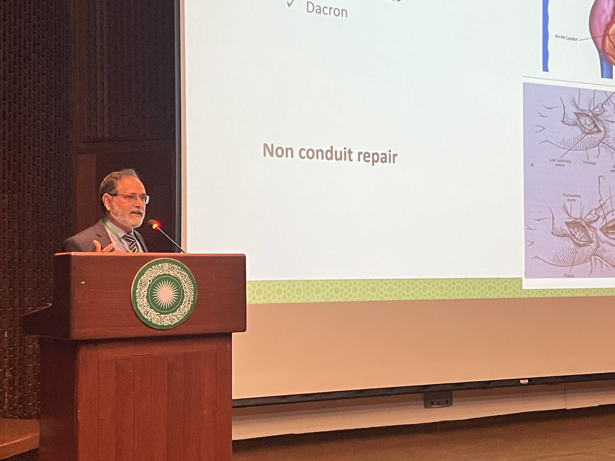 Superb Grand rounds talk by Dr. S Shahabuddin on his work with the Ross procedure at AKU and his innovative use of local solutions to the conduit! @AKUGlobal @AkuSurgery has so much talent!! Need to highlight and share their work! @SaulatFatimi @AdilHaiderMD