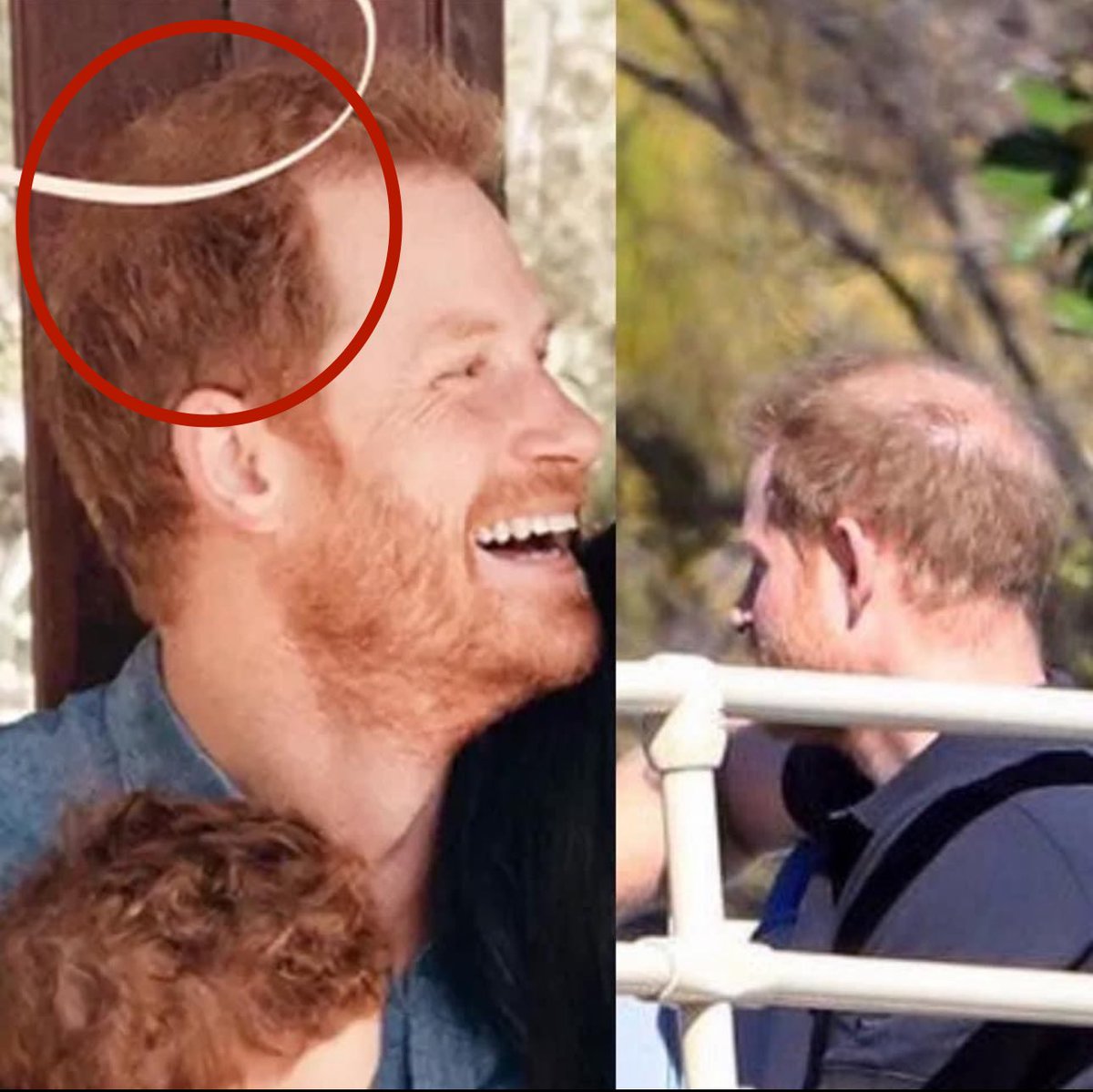 TheHRHCeline's tweet photo. .@AP, @GettyImages &amp; @PA: We don’t allow manipulated images into our database!

“Sources” close to Harry &amp; Meghan: H&amp;M would never be so sloppy! M’s meticulous! 💅

Reality: Wonky foot that looks half shaved off, fake hair added to hide alarming baldness, Lily w/elongated fingers https://t.co/UJwDfwclzs