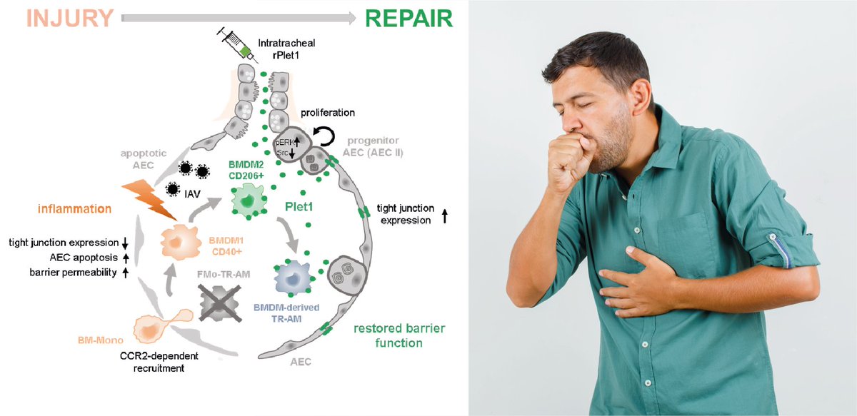 New hope for future pneumonia treatments. CPI researchers <a href="/LeartaO/">Learta Pervizaj-Oruqaj</a> und <a href="/balahumed/">Bala.CSK</a> from <a href="/jlugiessen/">Universität Gießen</a> have shown the healing role of Plet1 in lung tissue after #Influenza  induced pneumonia. 

<a href="/HeroldLab/">Herold Lab</a> #LungHealth 

Read more: nature.com/articles/s4146…
