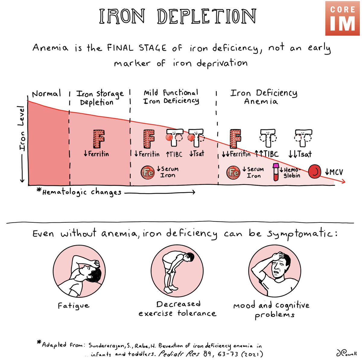 1/🚨NEW #GrayMatters segment on iron deficiency🚨 Note: we didn’t say “iron deficiency anemia”! Anemia is the FINAL STATE, not an early marker! 🎧: link.chtbl.com/FeDef 🖥️: bit.ly/4aaMLnz ACP CME: bit.ly/CIMCME Sponsor: coreimpodcast.com/Freed