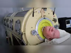 Paul Alexander, nicknamed "Polio Paul," has died at 78 after spending years in an iron lung due to polio paralysis.
Paul was paralyzed from the neck down by polio at the age of six and spent his life in the machine as he was unable to breathe on his own.