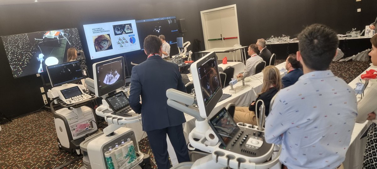 Luis Nombela-Franco (@luisnombela) on Twitter photo Simulands en el CSC de estructural. Gran taller de reparacion tricuspide con Triclip y cierre de orejuela con dispositivo Watchman. <a href="/RodrigoEstvez1/">Rodrigo Estévez</a> <a href="/icruzgonzalez/">Ignacio Cruz Gonzalez</a> <a href="/StructuralBCN/">Dabit Arzamendi</a> #CSCEstructural24 Simulands en el CSC de estructural. Gran taller de reparacion tricuspide con Triclip y cierre de orejuela con dispositivo Watchman. <a href="/RodrigoEstvez1/">Rodrigo Estévez</a> <a href="/icruzgonzalez/">Ignacio Cruz Gonzalez</a> <a href="/StructuralBCN/">Dabit Arzamendi</a> #CSCEstructural24