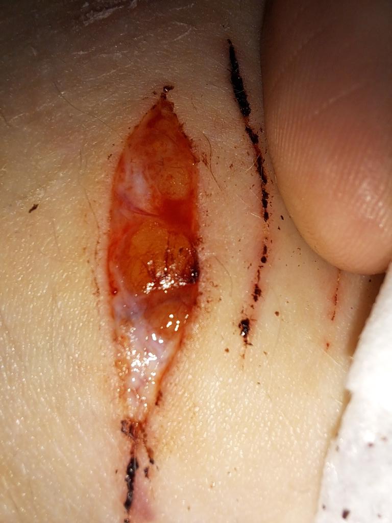 apvlI0's tweet photo. y'all think this'll leave a scar 🥺🥺🥺 /s https://t.co/GEHRJqDs6k