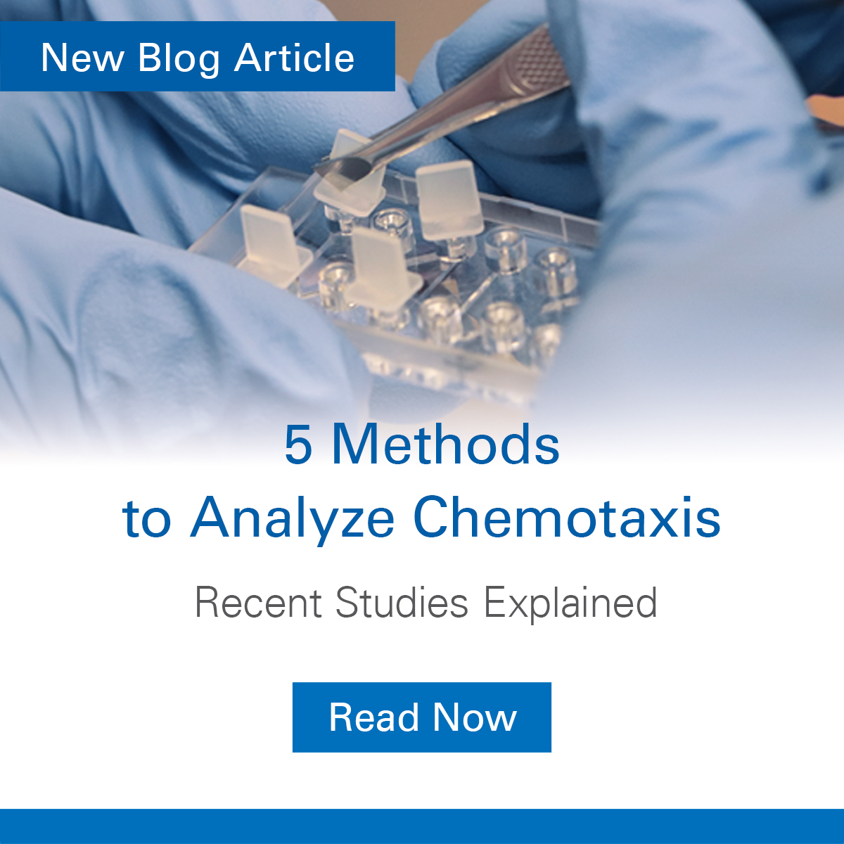 ibidiCells's tweet photo. 👓Check out our latest blog: https://t.co/QNZodswVJj
💡 In this insightful blog, we explore recent research articles showcasing diverse approaches to studying chemotaxis.
#Biology #Research #Science #Immunology #CancerResearch #Biotechnology #NewBlog #RealTimeVisualization https://t.co/dXtZ7MBoqc