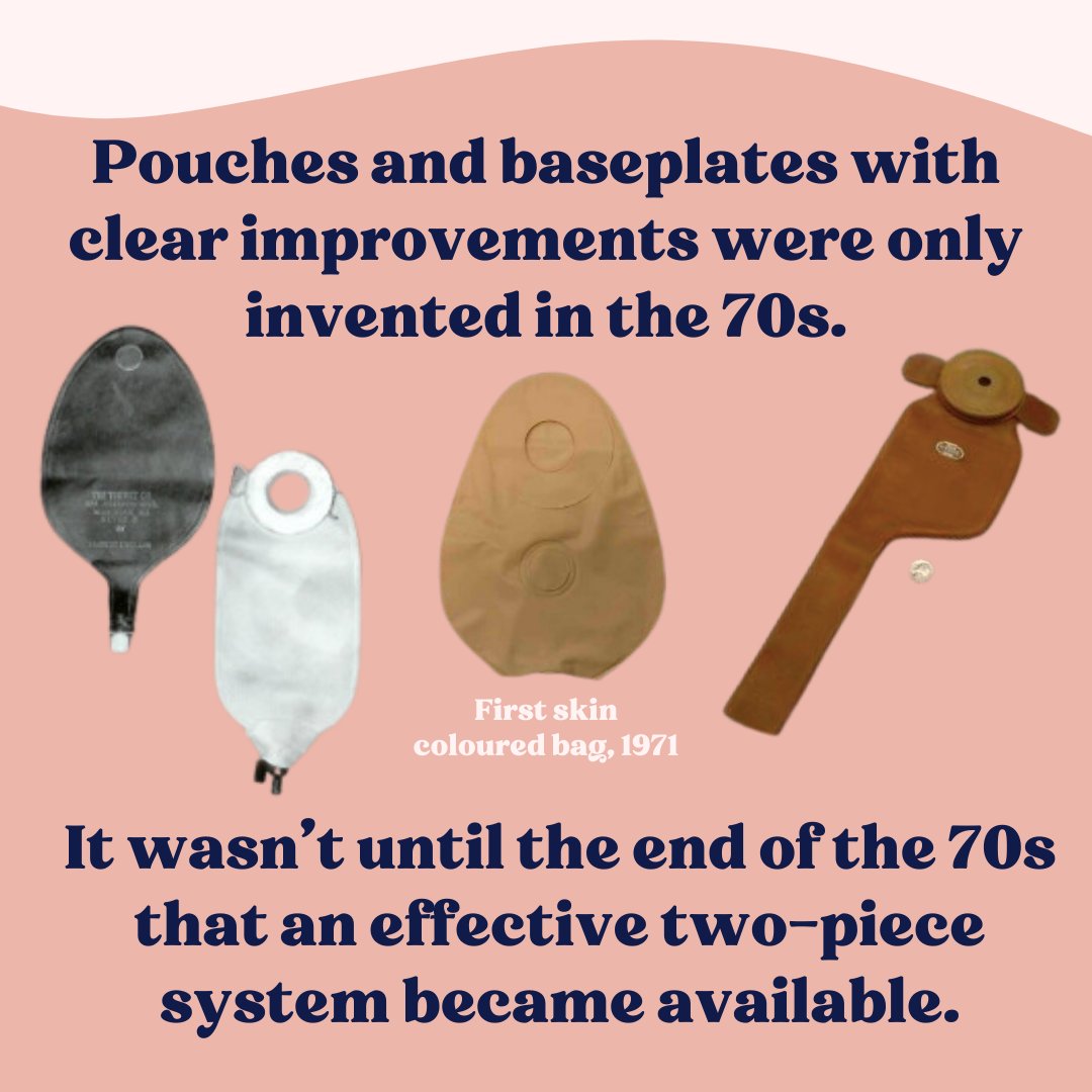 The history of stoma surgery predates the widespread availability of modern appliances, leading to the utilisation of various alternative methods throughout time. [Sources - 'Een Kwart eeuw stomazerg in Nederland', 'Baas op eigen buik' and PelicanHealthcare.co.uk]