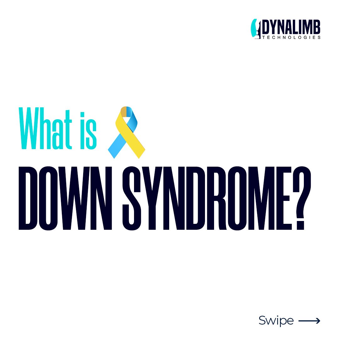 dynalimb's tweet photo. What really is down syndrome🤔and how can the condition be managed😃?
Welcome to our series of knowing all there is to down syndrome.
#Dynalimbs #ProthesticsandOrthotics #orthopaedics #surgery #health #physicaltherapy #cerebralpalsy #disabilityawarenes #downsyndrome https://t.co/HJWBw6fn5D