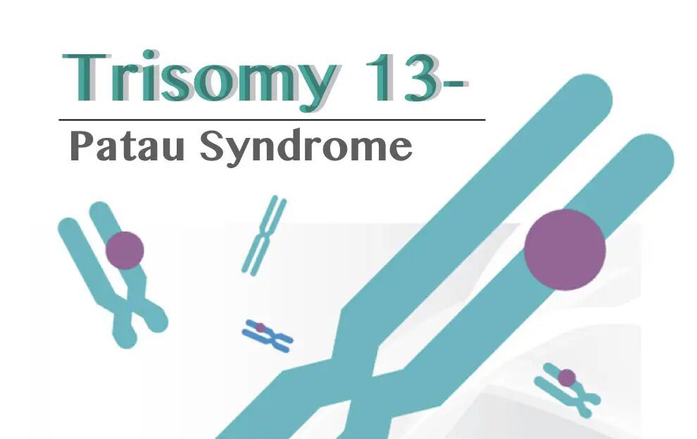 Trisomy 13, also known as Patau syndrome, is a genetic disorder that occurs when a baby has an extra copy of chromosome 13 in their cells.

Read more on Trisomy 13:
cyc.org.zw/index.php/2024…

#TrisomyAwarenessMonth #trisomyawareness #trisomy13