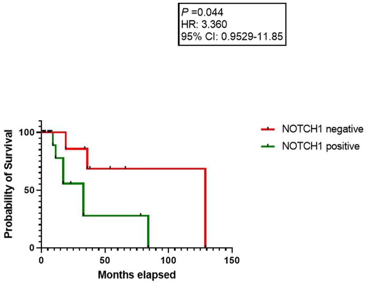 AlirezaSalem2's tweet image. Very excited to share our paper (Impact of NOTCH1 expression in primary breast adenoid cystic carcinoma) just published in @JClinPath_BMJ
#pathology #PathTwitter #breastpath #pathresidents #BreastPatholog1
@ColumbiaPath @Columbia @MDAndersonNews @TheISBP 
doi.org/10.1136/jcp-20…
