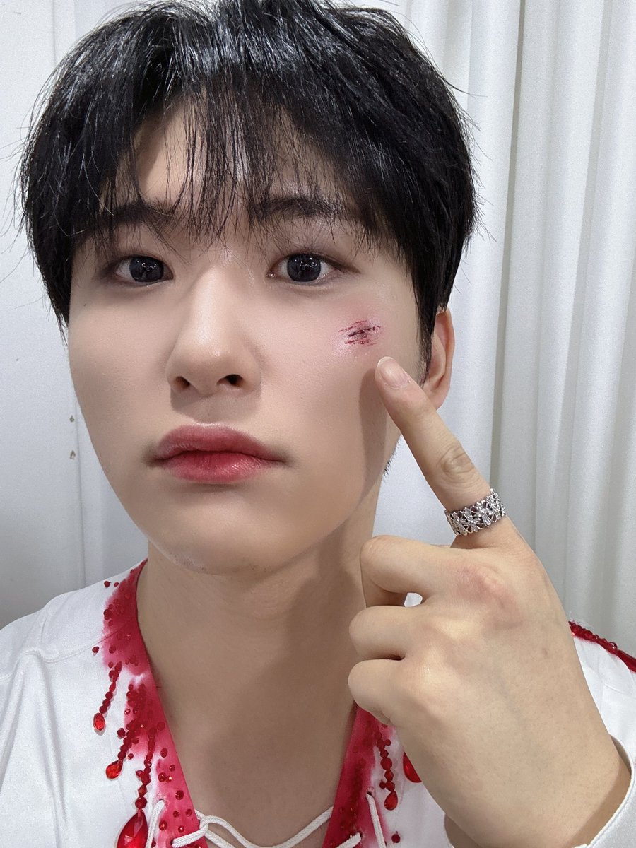 CRAVITY_twt's tweet photo. 상처를 치료해 줄 러비티 어디 없나 ~
#우빈 https://t.co/ReOY1nqVk5