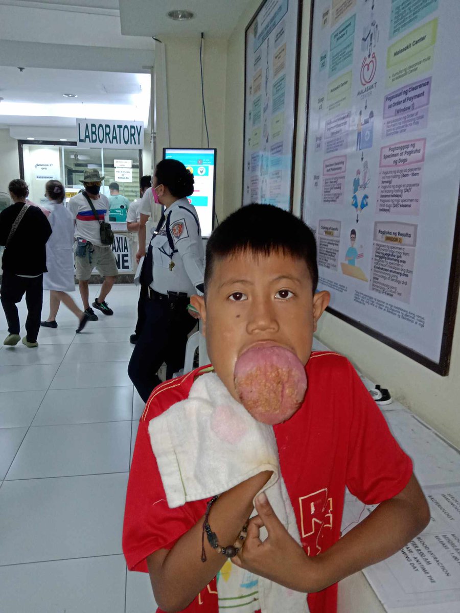 Leo was back in Manila and got his checkup today. We've been trying to help them for almost 2 years now, unfortunately he still can't get surgery.

Doctors said for now he needs  to maintain the sirolimus tablet for 1-2 years depending on the progress. Leo needs approximately