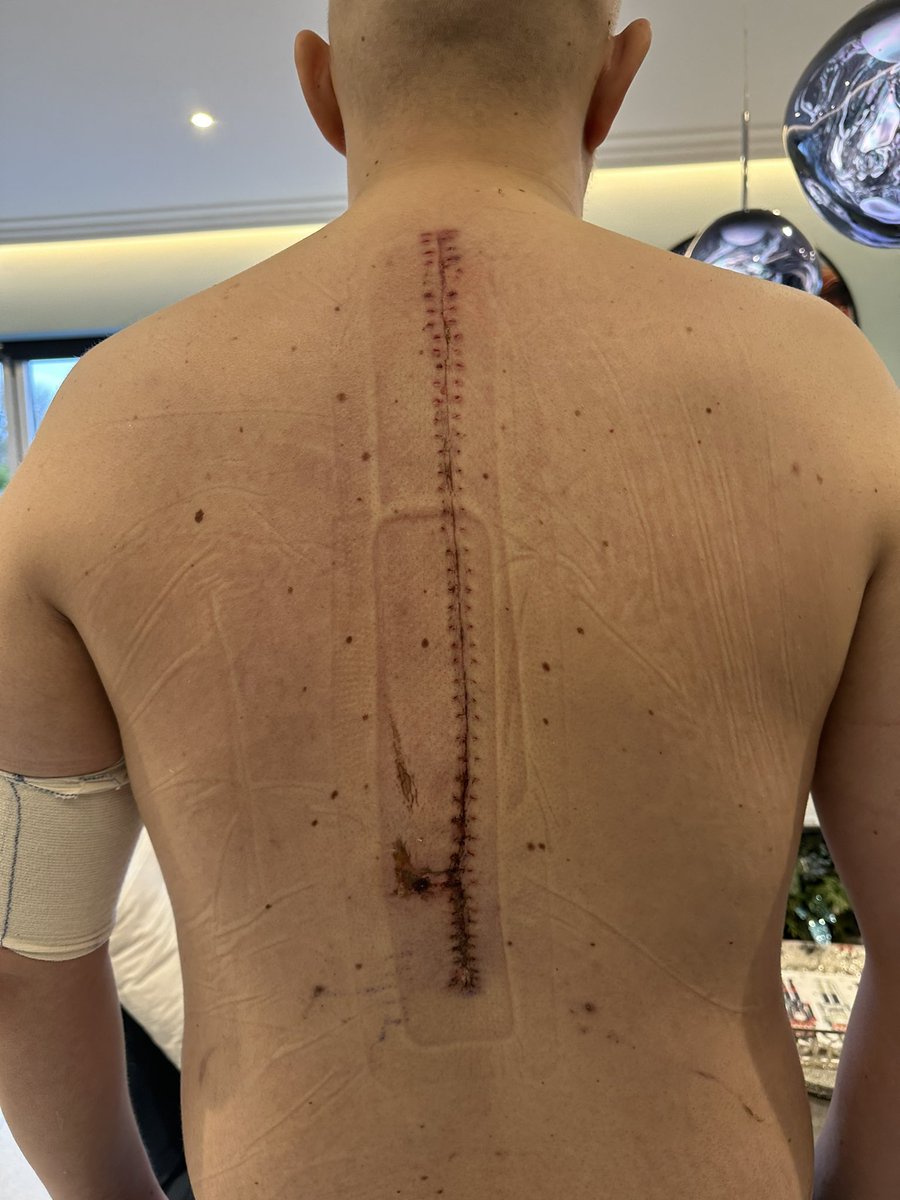 My name is Alex and, for the last 9 months, I’ve been fighting back against Ewing’s Sarcoma (cancer). Life has been tough and in my darkest hours, I made a bucket list of sorts to keep me going when I got better! At the top of the list- Watch England play at EURO 2024… 💪