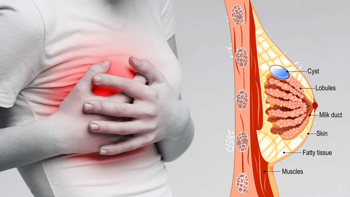 PUltrasoun36370's tweet image. Breast cancer remains one of the most prevalent and potentially life-threatening conditions affecting women worldwide. 
#BreastScan #BreastUltrasound

phoenix-ultrasound.co.uk/understanding-…