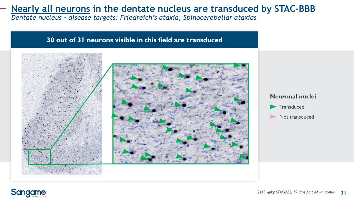BiotechAnalysst's tweet photo. $SGMO the STAC-#BBB capsid: 
STAC-BBB outperforms other published CNS-tropic capsids
#Friedreichs ataxia
#Spinocerebellar ataxia
#AlsahurYa 
#Rett Syndrome
#Parkinson
#Alzheimers 
...
lots of slides: https://t.co/wC2hP28jgg https://t.co/7cXoUBpYgL