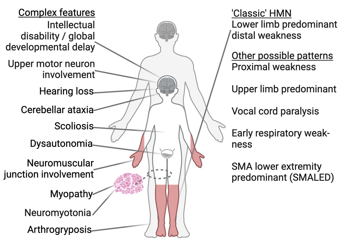🎉 Exciting News / book chapter Alert! 📚🧠 My chapter on Hereditary Motor Neuropathies (HMN) has been officially published in the Encyclopedia of the Neurological sciences, Third Edition! sciencedirect.com/science/articl…