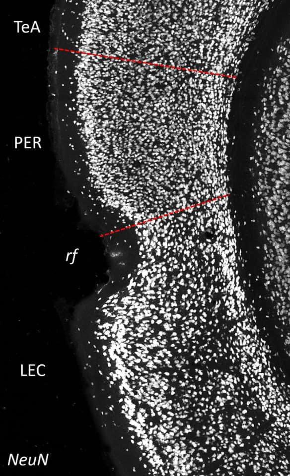 MaxNigro_Neuro's tweet photo. Mine is the perirhinal cortex with its weird inhibitory population
https://t.co/t5wPI6jnDR
#NigroLab @KISNeuro @NTNUhelse https://t.co/C1OIwkupbs