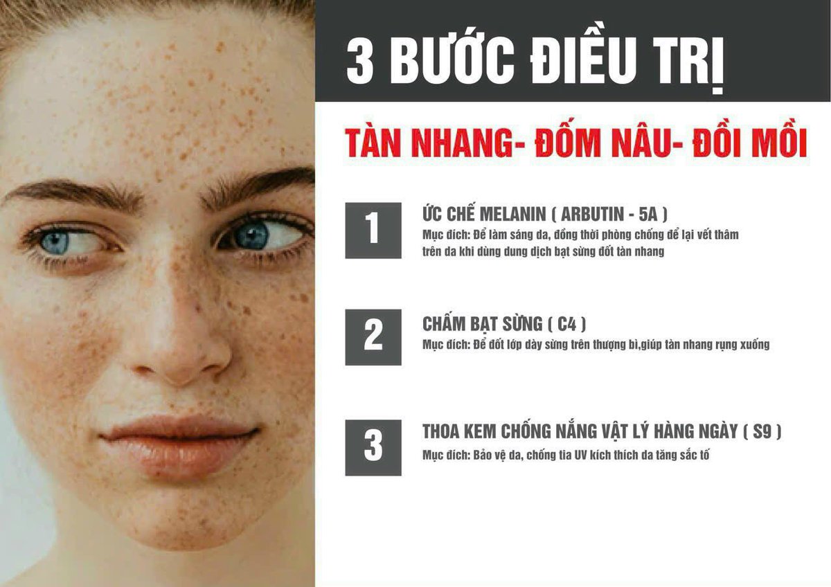 bapbebong1's tweet photo. 3 BƯỚC ĐIỀU TRỊ 
TÀN NHANG - ĐỐM NÂU - ĐỒI MỒI https://t.co/PVkYjThHnK