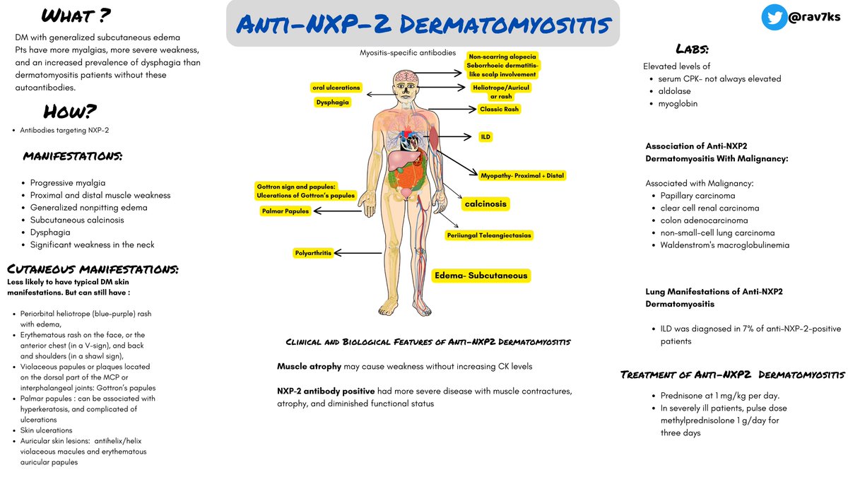 Anti-NXP2 dermatomyositis: a rare autoimmune disorder characterized by skin rash, muscle weakness, and potential internal organ involvement. Understanding its pathogenesis and clinical features is vital for timely diagnosis and tailored treatment strategies. #MedEd #MedTwitter