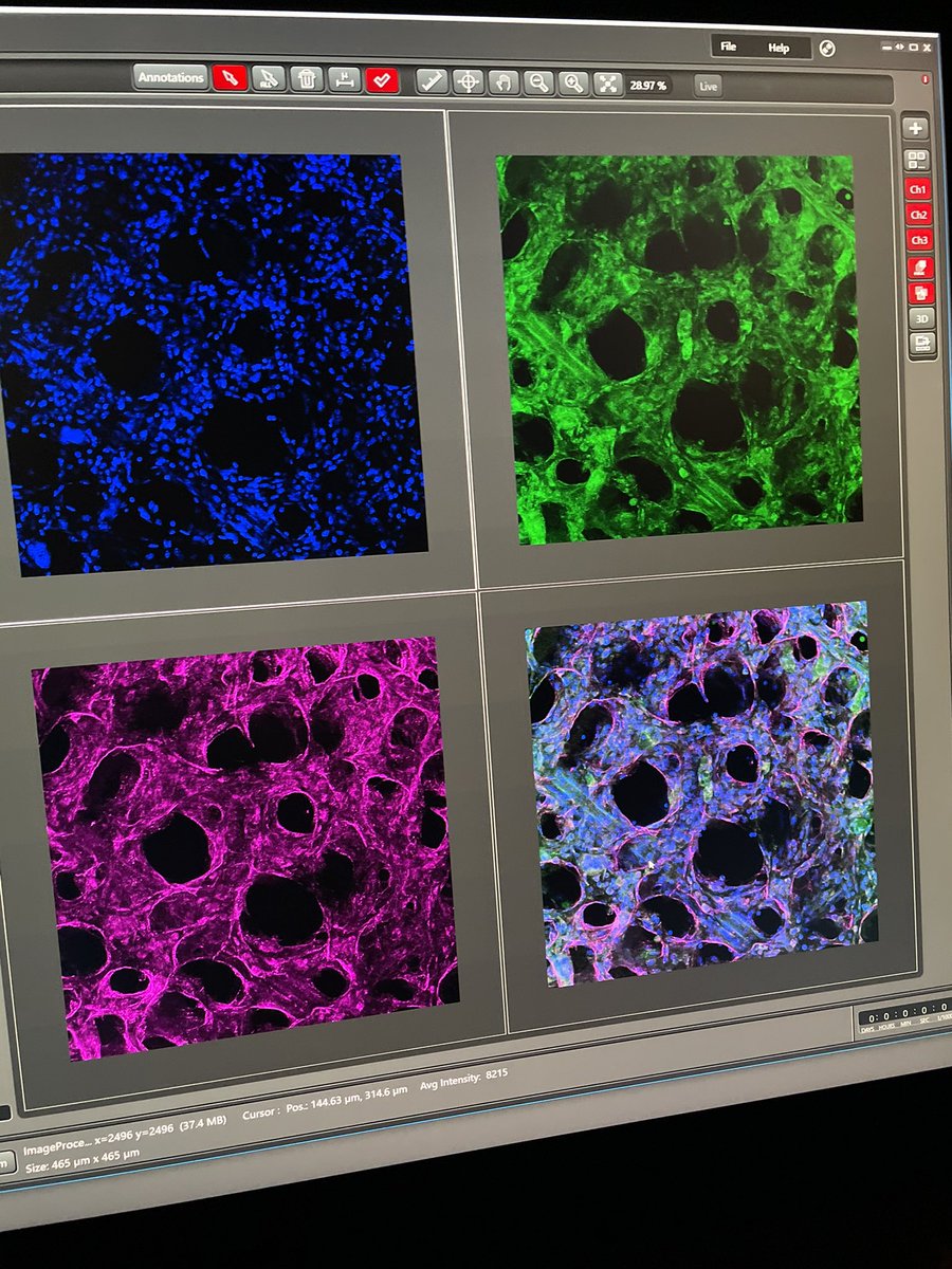 Reviewer comment: “It is recommended that the PI include in the proposal a collaborator who is an expert in bone marrow imaging.”

What the actual f*ck? I am the expert in bone marrow imaging! 🤯🤯🤯

How do you respond to a comment like this?