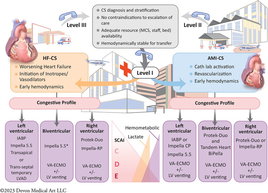 Contemporary approach to cardiogenic shock care: a state-of-the-art review @FrontCVMedicine frontiersin.org/articles/10.33…