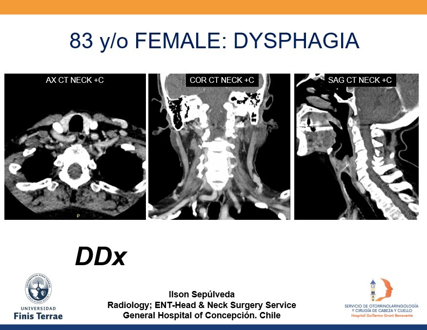 Interesting case... GIF, answer, similar case or whatever you want!!! @darkahadnadjevs @drscottrice @drSurjthVattoth @MohitAgNeurorad @RamVaidhyanath @entradiology