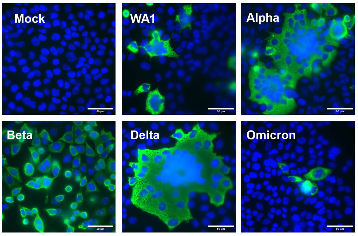 Congrats to Nikki Tanneti, Susan Weiss and the team for their exciting study of SARS-CoV-2 variants in authentic primary human nasal epithelial cells. Turns out Delta is most cytopathic while Omicron is fastest replicating. PMID: 38477472