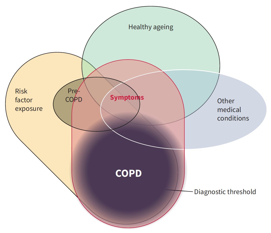 Factors to be considered when defining COPD. Healthy ageing and/or exposure to risk factors may lead to development of symptoms such as breathlessness and/or to pre-COPD. Other medical conditions may also lead to symptoms. Pre-COPD may progress to COPD or may resolve.…