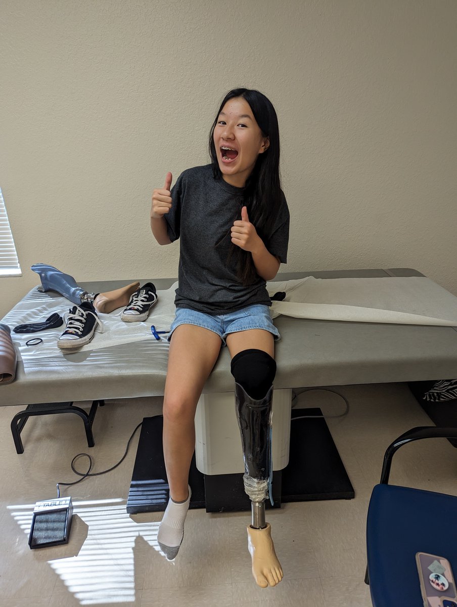#SCFLA patient, Allison, has grown up wearing prosthetics customized for her by the team in #POPS. ❤️ Our experienced pediatric-focused practitioners understand the unique requirements of children’s growing bodies & how they evolve over time. Learn more at tinyurl.com/28smmcjr