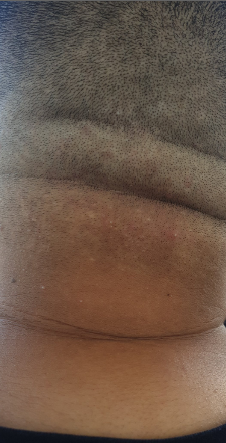 NuquedewalidOff's tweet photo. La vraie nuque de Walid, 100% authentique ! OMG, c'est la vraie nuque de Walid, 100% réelle. Si vous êtes fan de nuques et de moments épiques, vous êtes au bon endroit ! 😎 #LaVraieNuque #AuthentiqueWalid  #NuqueCélèbre
#NuqueÉpique
#NuqueEnOr
#NuqueParfaite
#NuqueDeRêve https://t.co/nTkBOAHUde