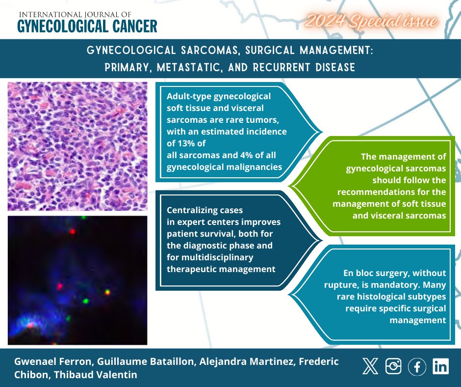 IJGConline's tweet image. #2024SpecialIssue Gynecological #sarcomas, surgical management: primary, metastatic, and recurrent disease

📌 bit.ly/4a0mQ26

@pedroramirezMD @HsuMd @JayrajAarthi @AndreFernandes2 @IGCSociety @ESGO_society @ENYGO_official @OncoAlert @IJGCfellows @GynMe4