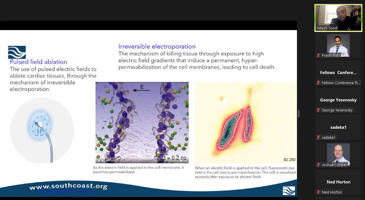 Thank you @EffieNitsdoc @SouthcoastHlth for a primer on Pulsed Field Ablation today for @TempleHealth THVI Grand rounds! @TempleCards @HRSonline #PFA #AF