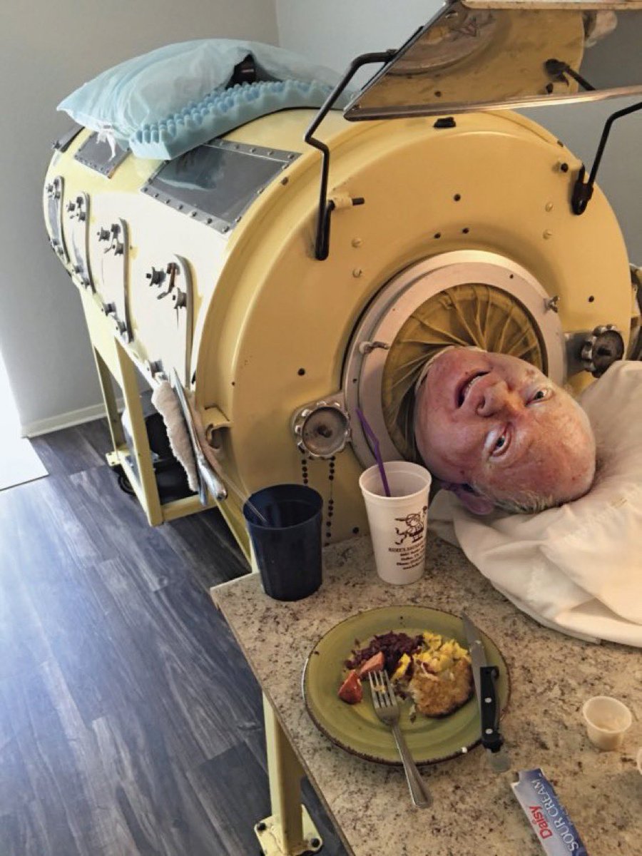 Bezeley_MBChB's tweet photo. Paul Alexander has sadly passed away at the age of 78, having spent 70 years confined to an iron lung after contracting polio at the age of six.

Crazy medical story... 

A Thread👇 https://t.co/XS0Mmr114w