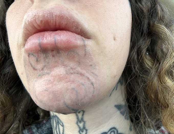 Tattoo removal sessions are more painful than child birth. I repeat, DO NOT GET TATTOOS ON YOUR FACE