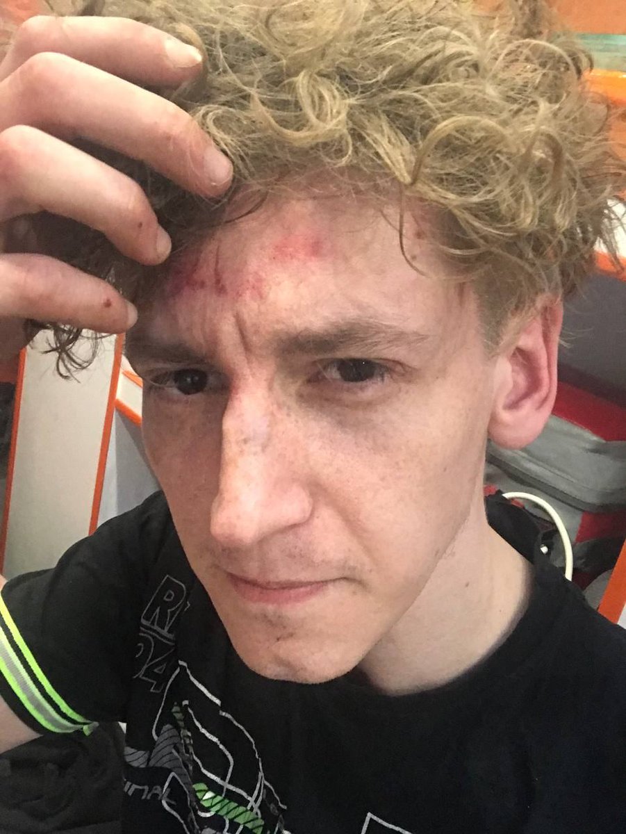 TWMCLtd's tweet image. Another day in the fascist state, another political beating. This is the Russkiy Mir which Putin wants us all to live under, so let's help #Ukraine stop the evil.

This is Konstantin Larionov, head of Boris Nadezhdin's election HQ after he was attacked in #Kaluga

#StopPutin