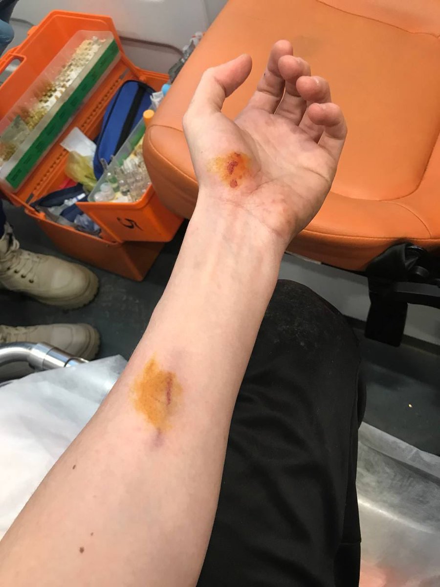 TWMCLtd's tweet image. Another day in the fascist state, another political beating. This is the Russkiy Mir which Putin wants us all to live under, so let's help #Ukraine stop the evil.

This is Konstantin Larionov, head of Boris Nadezhdin's election HQ after he was attacked in #Kaluga

#StopPutin