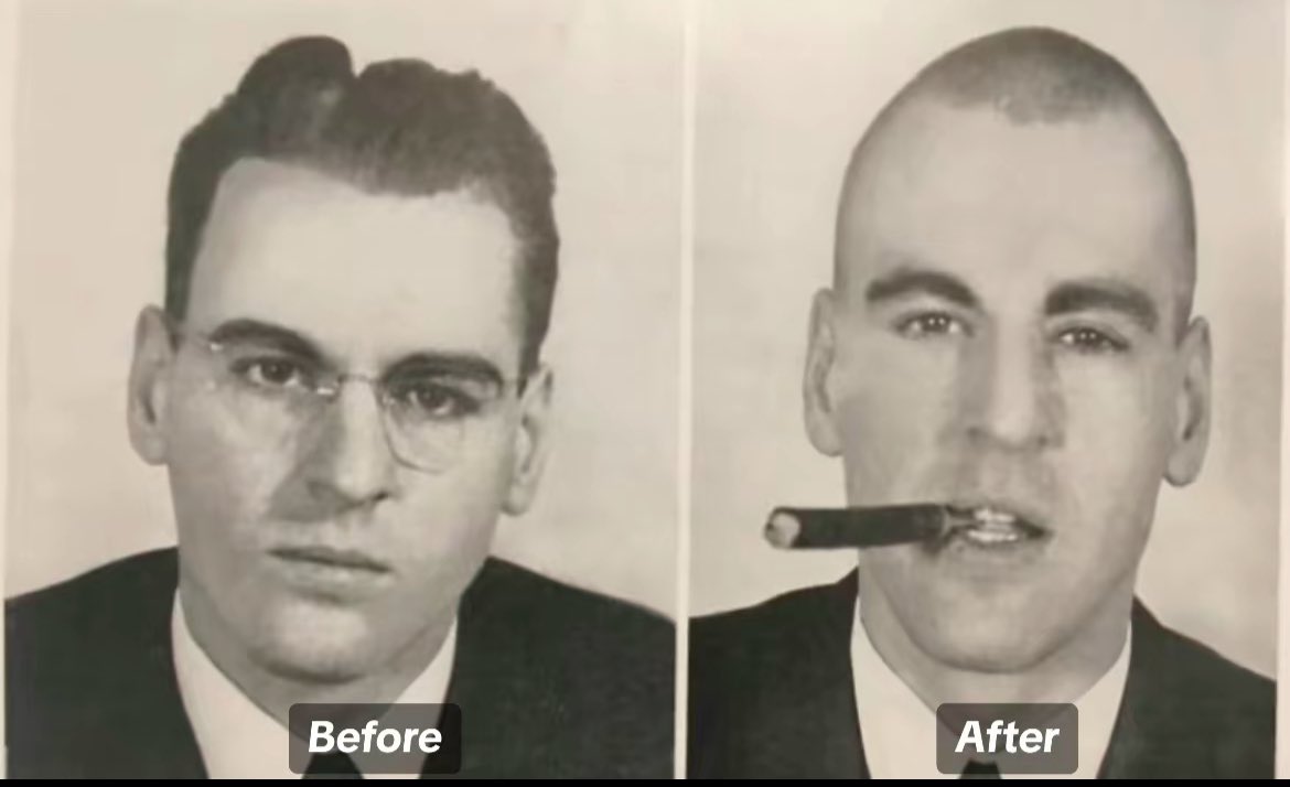 this is my favorite lobotomy before and after picture ever i would get one if i saw this on the news