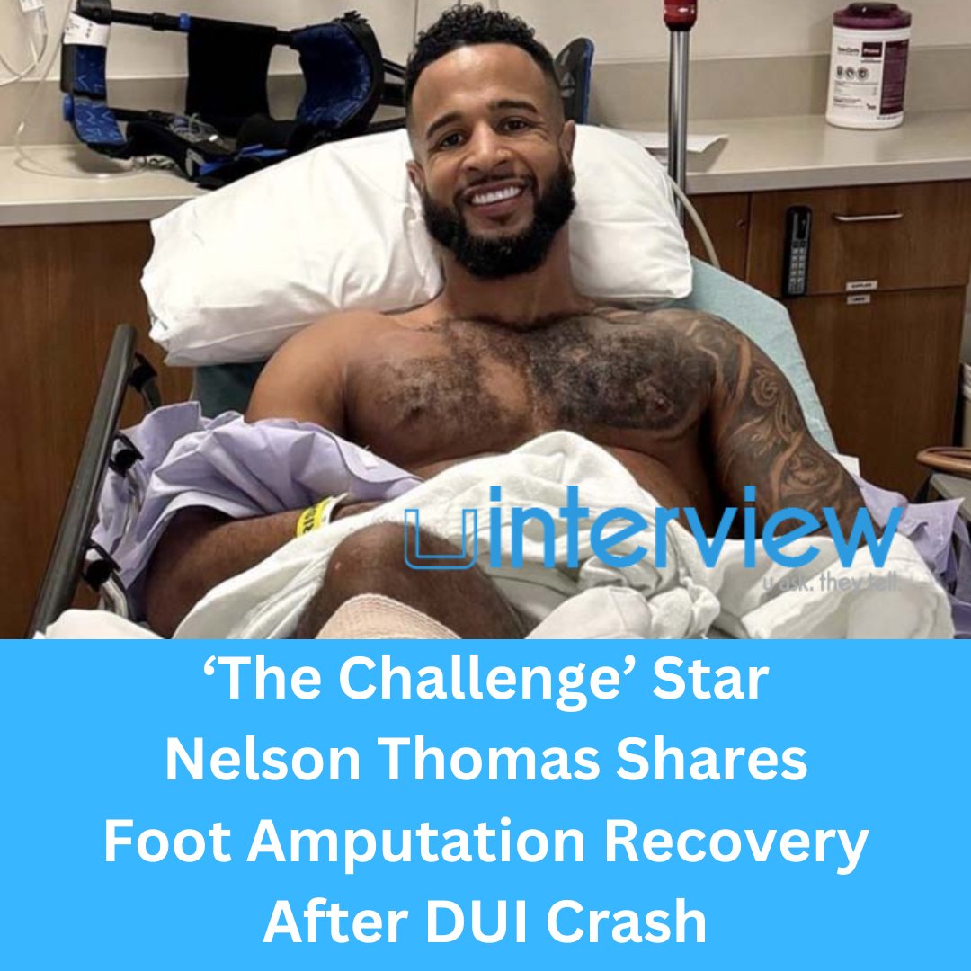 uinterview's tweet photo. Full Story: https://t.co/ngcAZ6rzzU
Nelson Thomas, a star on the MTV reality series The Challenge, underwent a foot amputation one year after his near-fatal car crash.
#nelsonthomas #thechallenge #KJOsborn #MTV #celebrity https://t.co/GSTK2WslvZ