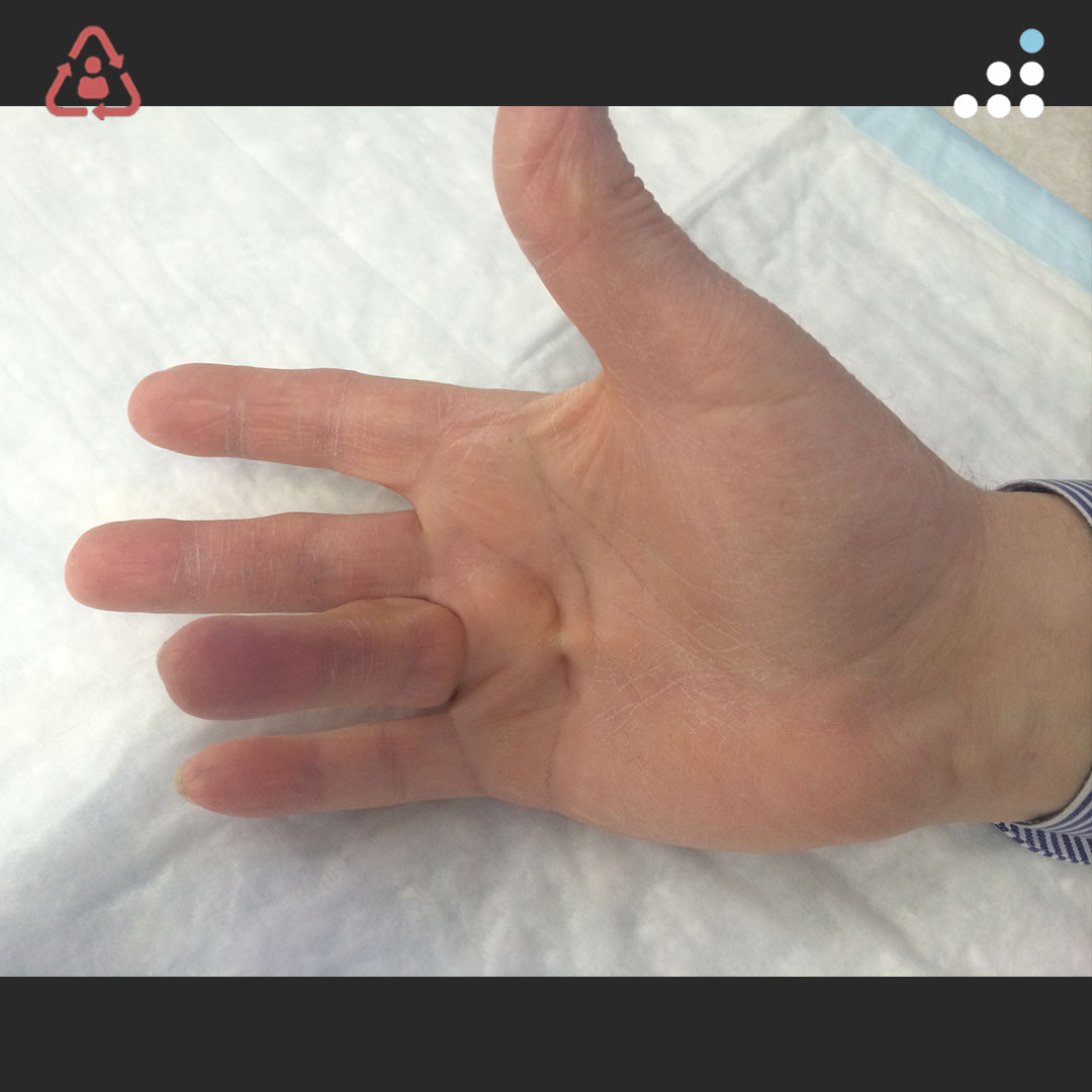 Orthobullets tweet media