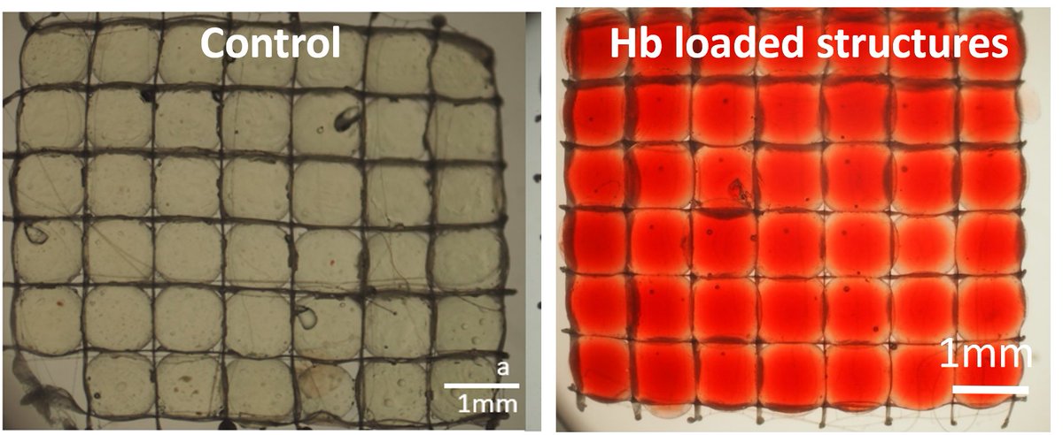 Gabriella Lindberg (@lindberglabs) on Twitter photo Excited to announce <a href="/AxeNorb/">Axel Norberg</a> work, detailing our protocol to incorporate hemoglobin in gelatin-heparin hydrogels with maintained function to deliver oxygen in bioassembled MEW constructs with MSCs: doi.org/10.1088/1758-5…
<a href="/Tim_WoodfieldNZ/">Tim Woodfield</a>
<a href="/Khoonono/">Khoon Lim</a>
<a href="/meltelectrospin/">Paul Dalton</a>
<a href="/esgisss/">Ezgi Bakirci</a> Excited to announce <a href="/AxeNorb/">Axel Norberg</a> work, detailing our protocol to incorporate hemoglobin in gelatin-heparin hydrogels with maintained function to deliver oxygen in bioassembled MEW constructs with MSCs: doi.org/10.1088/1758-5…
<a href="/Tim_WoodfieldNZ/">Tim Woodfield</a>
<a href="/Khoonono/">Khoon Lim</a>
<a href="/meltelectrospin/">Paul Dalton</a>
<a href="/esgisss/">Ezgi Bakirci</a>