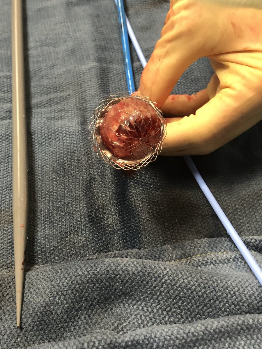 jacc.org/doi/10.1016/j.…

#ŌNŌ_vs_WATCHMAN 
#ŌNŌ_helps