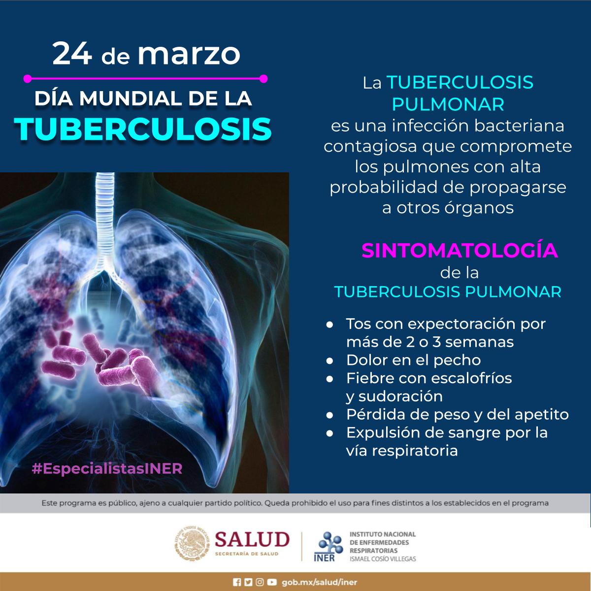 24 de marzo de 2024 | Día Mundial de la Tuberculosis

#EspecialistasINER #DíaMundialdelaTuberculosis
