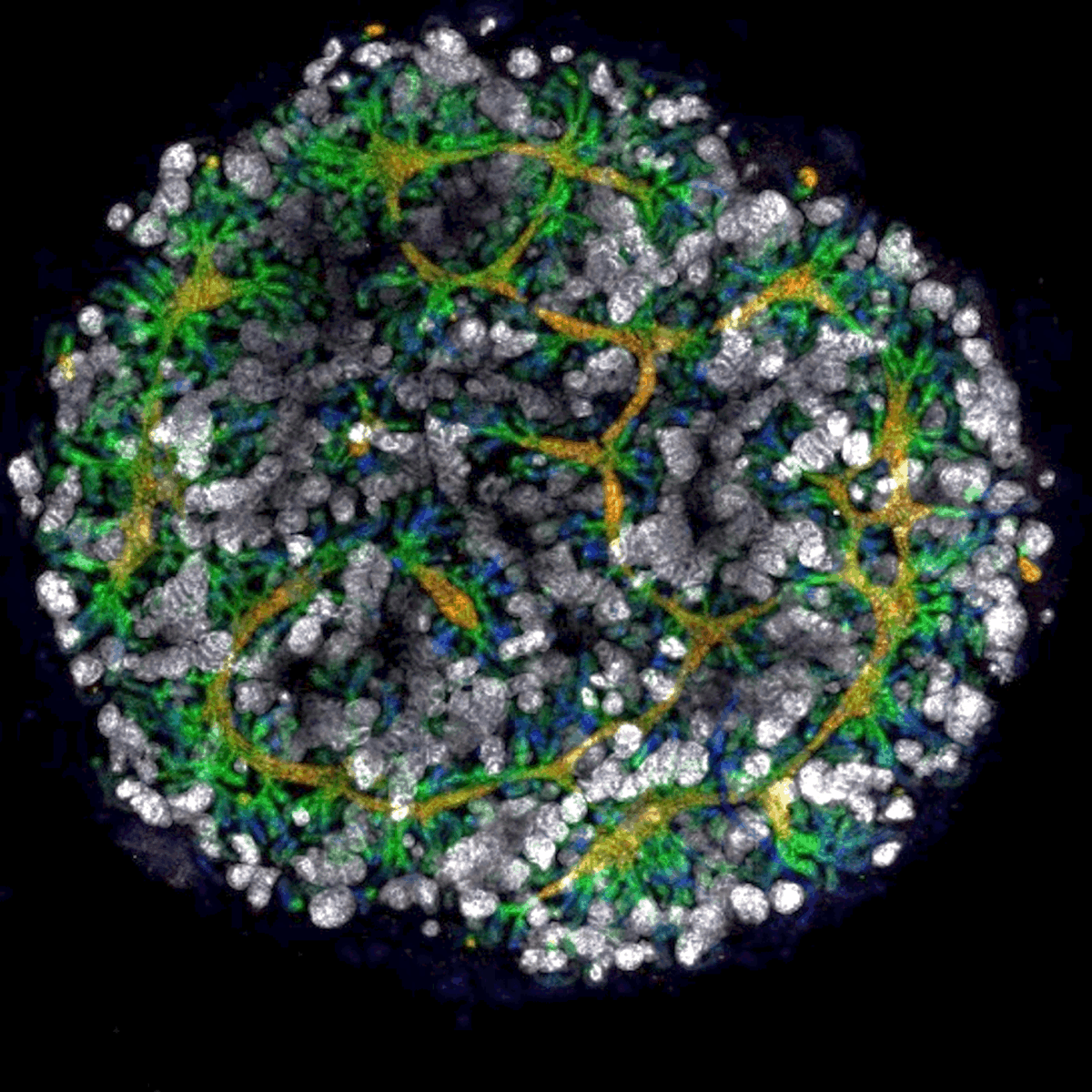 AusStemCell's tweet photo. Gene editing technology combined with stem cells provides a powerful new way to study genetic kidney diseases and their treatments.
Here's a 2019 story featuring @MCRI_for_kids researchers who are growing mini-kidney 'organoids' in the lab. #WorldKidneyDay
https://t.co/YEsi9ja9hz https://t.co/dhzCBpjNzH