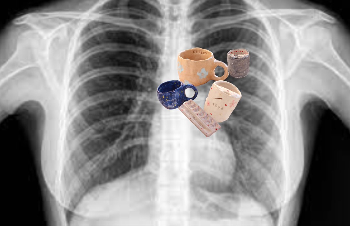FUJPOTTERY's tweet photo. When the doctor takes an X-ray of our hearts https://t.co/q3ImtQgbx7