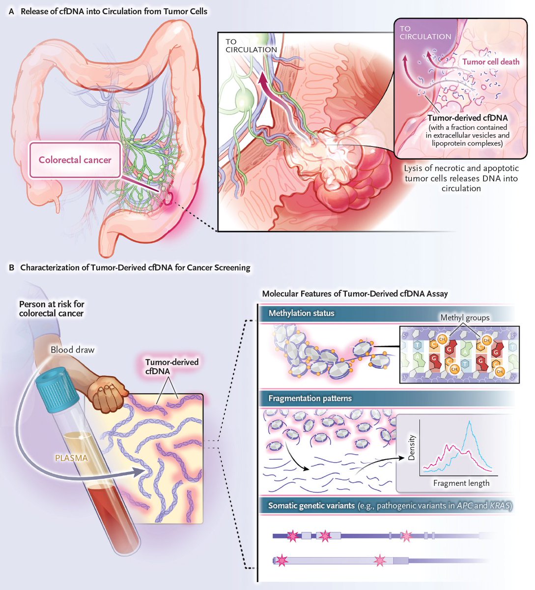 This editorial describes the science behind a study of a noninvasive blood-based assay of cell-free DNA to screen for colorectal cancer in an average-risk population. Read the full editorial: nej.md/43noybx