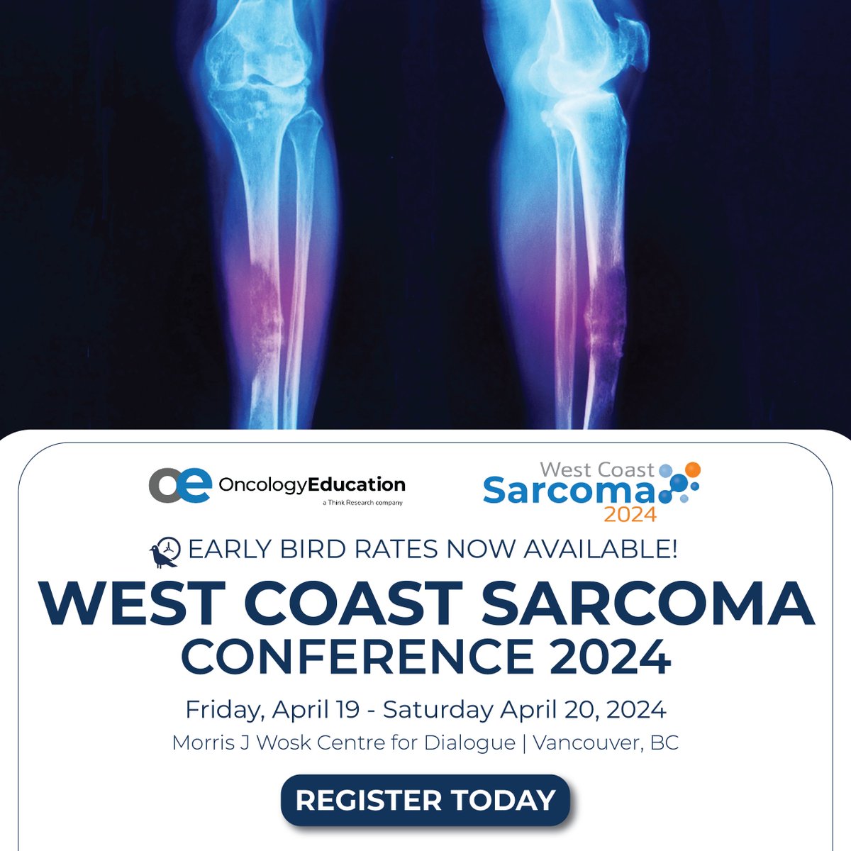 OncologyEducation (@onced) on Twitter photo 🚨Early bird rates end soon - register today! Join chairs <a href="/DrCESimmons/">Christine Simmons</a>, Dr. Lee Cranmer, Dr. Caroline Holloway <a href="/s_banerji/">Shantanu Banerji 🇨🇦🇿🇲🇮🇳</a> @ Canada’s premier event designed to address knowledge gaps in the multidisciplinary treatment & management of #sarcoma. 👉 ow.ly/j2j450QQoCA
#WCS2024 🚨Early bird rates end soon - register today! Join chairs <a href="/DrCESimmons/">Christine Simmons</a>, Dr. Lee Cranmer, Dr. Caroline Holloway <a href="/s_banerji/">Shantanu Banerji 🇨🇦🇿🇲🇮🇳</a> @ Canada’s premier event designed to address knowledge gaps in the multidisciplinary treatment & management of #sarcoma. 👉 ow.ly/j2j450QQoCA
#WCS2024
